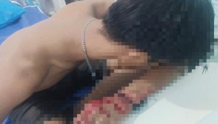 Duduk Santai Berakhir Petaka, Pria di Balikpapan Dipukul Brutal dengan Obeng